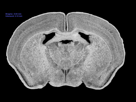 Mouse Brain Section