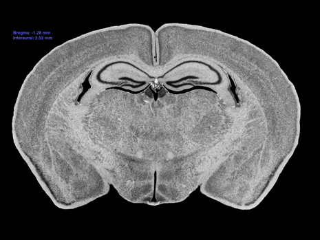 Mouse Brain Section