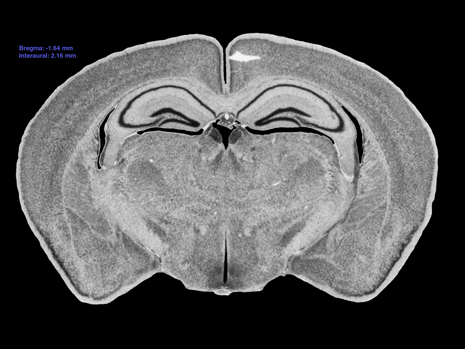 Mouse Brain Section