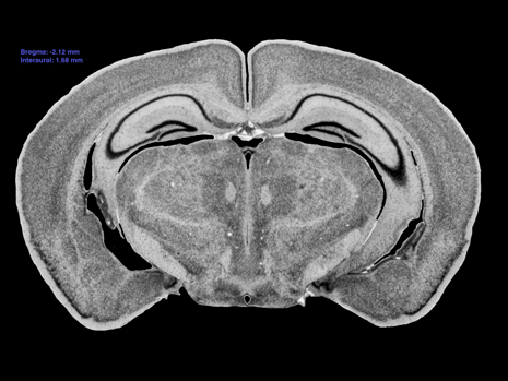 Mouse Brain Section