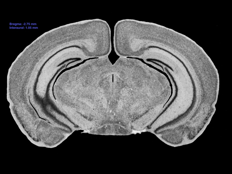 Mouse Brain Section