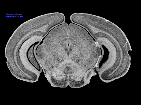 Mouse Brain Section