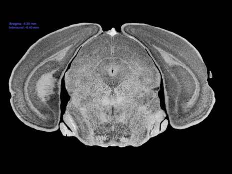 Mouse Brain Section