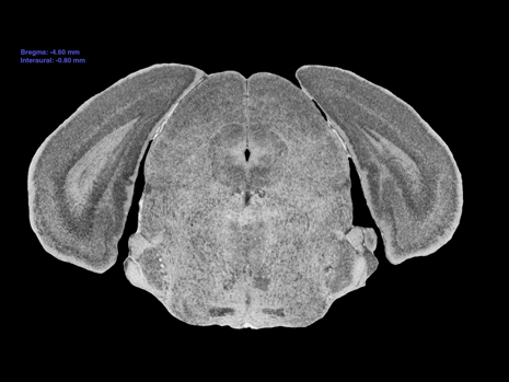 Mouse Brain Section