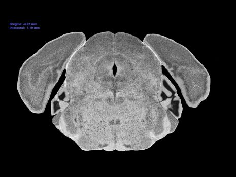 Mouse Brain Section