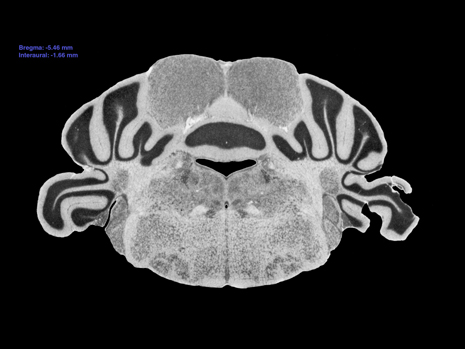 Mouse Brain Section