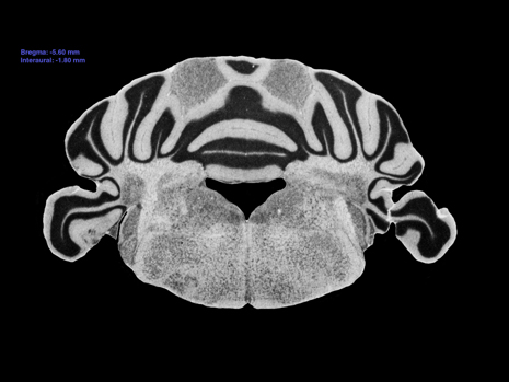 Mouse Brain Section