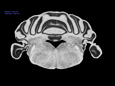 Mouse Brain Section