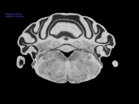 Mouse Brain Section