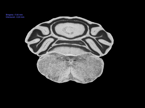 Mouse Brain Section