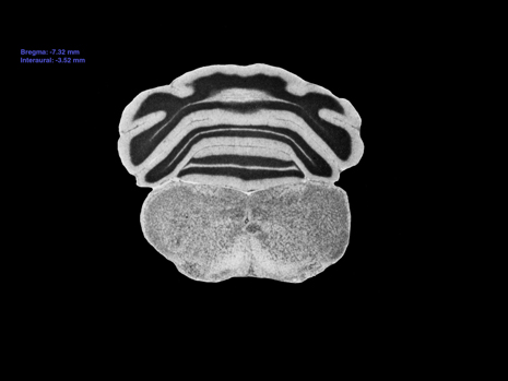 Mouse Brain Section