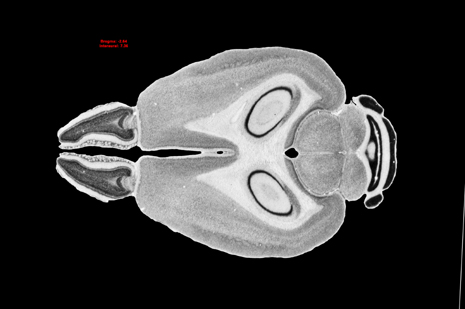 Mouse Brain Section