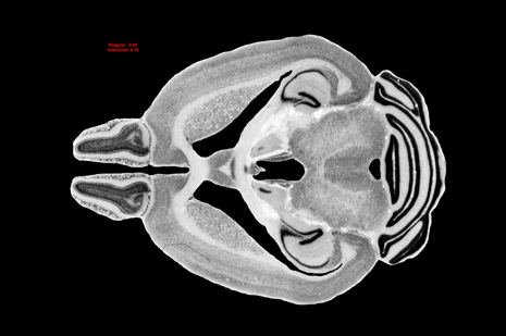 Mouse Brain Section