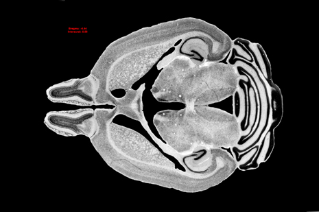 Mouse Brain Section