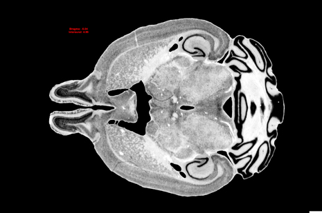 Mouse Brain Section