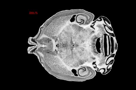 Mouse Brain Section