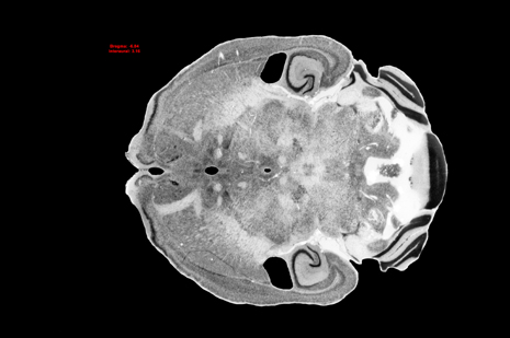 Mouse Brain Section