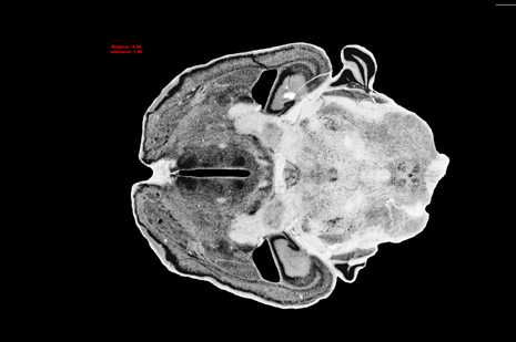 Mouse Brain Section