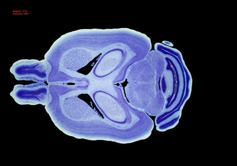 Mouse Brain Section