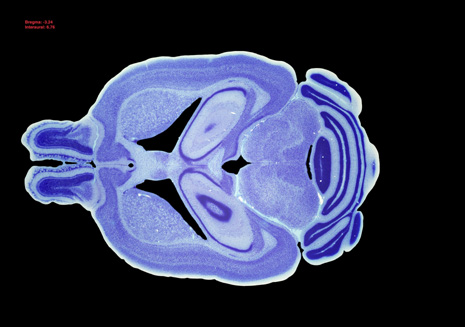 Mouse Brain Section