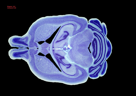 Mouse Brain Section