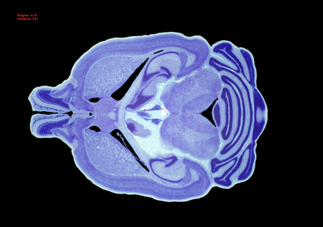 Mouse Brain Section