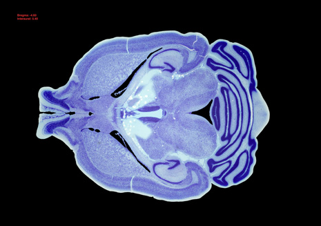 Mouse Brain Section