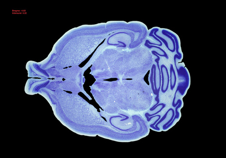 Mouse Brain Section