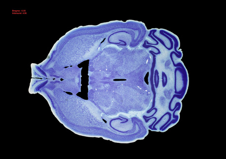 Mouse Brain Section