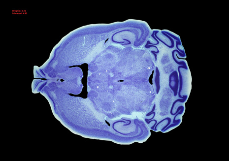 Mouse Brain Section