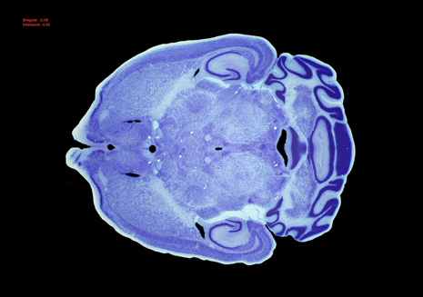 Mouse Brain Section