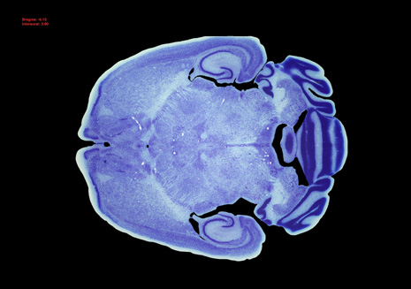 Mouse Brain Section