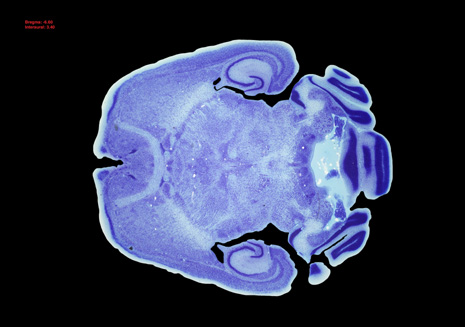 Mouse Brain Section