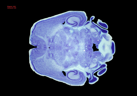 Mouse Brain Section