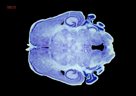 Mouse Brain Section