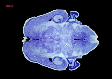 Mouse Brain Section