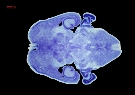 Mouse Brain Section