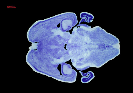 Mouse Brain Section