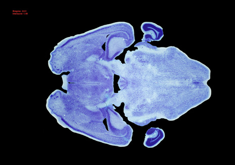 Mouse Brain Section