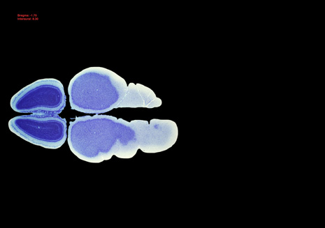 Mouse Brain Section