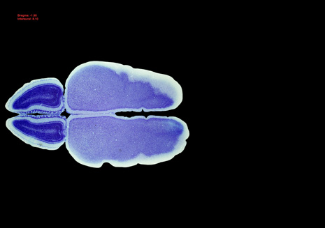 Mouse Brain Section