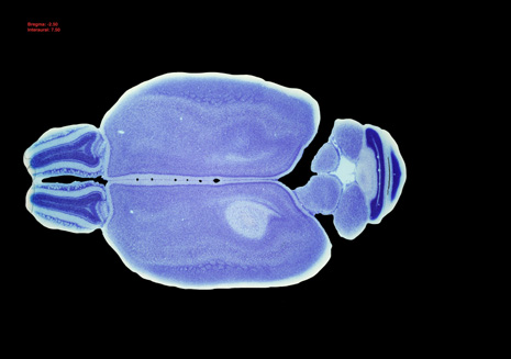 Mouse Brain Section