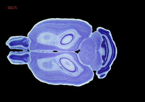 Mouse Brain Section