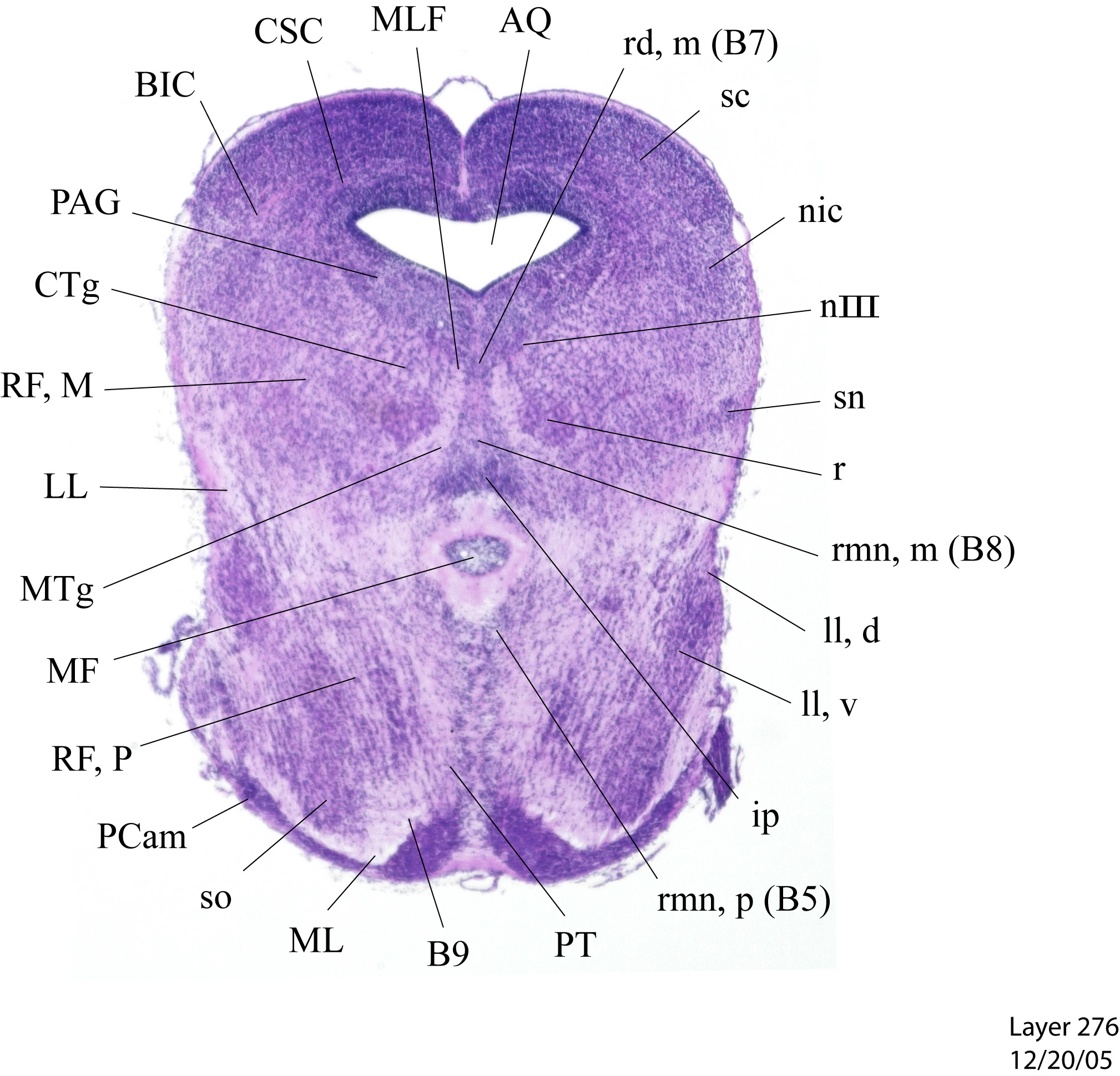 https://www.mbl.org/atlasgd16Coronal/atlasgd16label/276.jpg