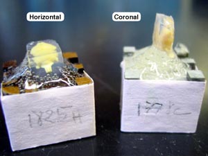 Brains Mounted on Embedding Blocks