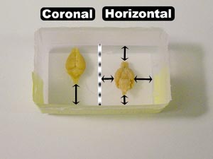 Positioning of Brains in Plastic Boat