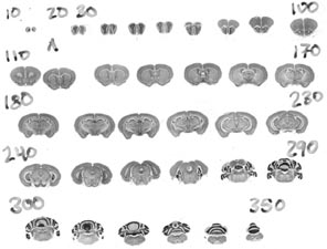 Proper Ordering of Coronal Sections