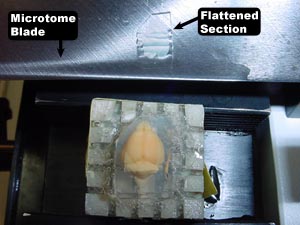 Flattened Horizontal Section